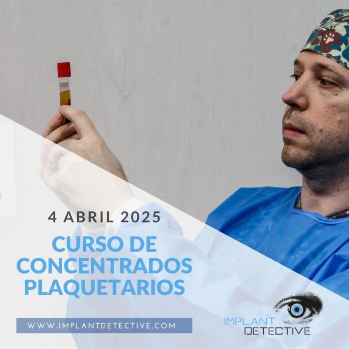 CURSOS Implant Detective